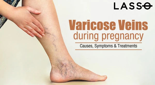 Vulvar Varicosities: Causes, Symptoms, Diagnosis & Treatment